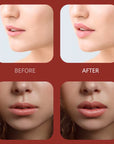 Natural Sexy Mouth Lip Enlargement Plumping Machine Automatic Soft Silicone Electric Quick Lip Plumper Device